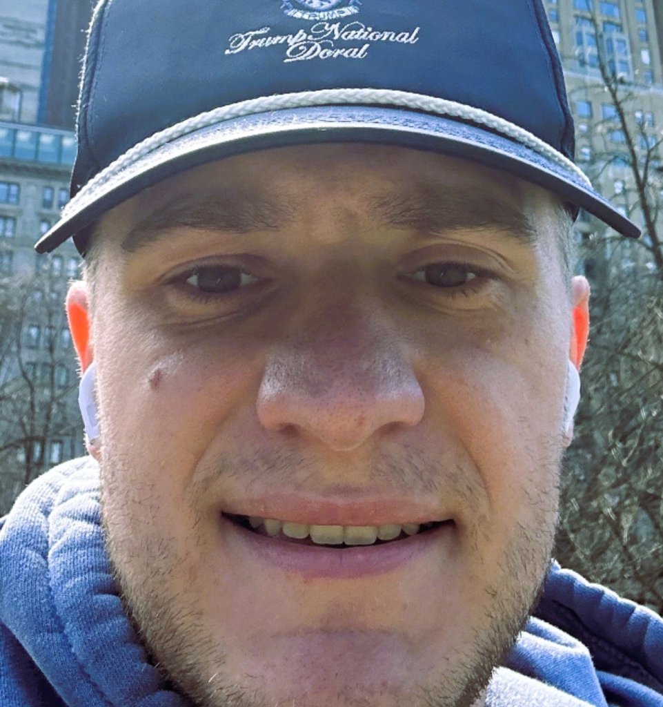 Front-facing photo of a man wearing a cap showing a visible mole on his face before removal procedure